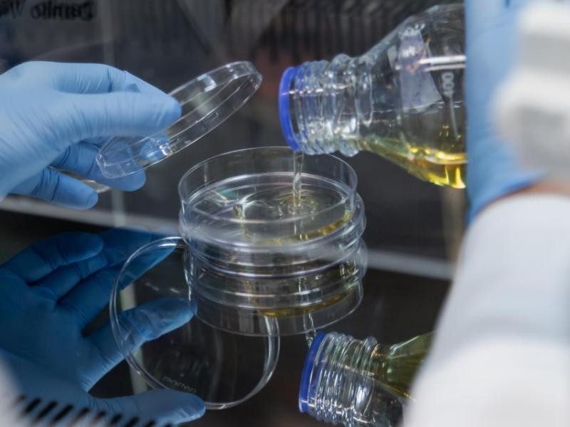 Bactérias heterotróficas: o que são e como afetam a qualidade da água?