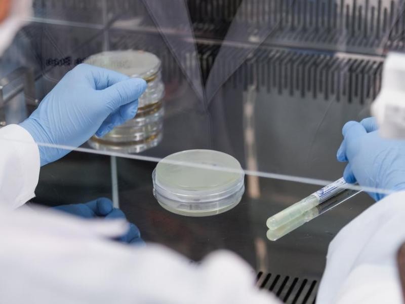 Análise Microbiológica em Utensílios em Igrejinha