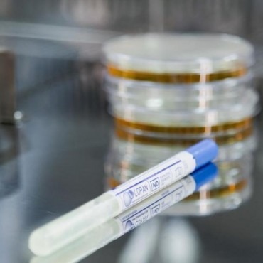 Análise Microbiológica em Superfícies em Portão