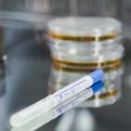 analise-microbiologica-em-superficies-em-porto-alegre-rs